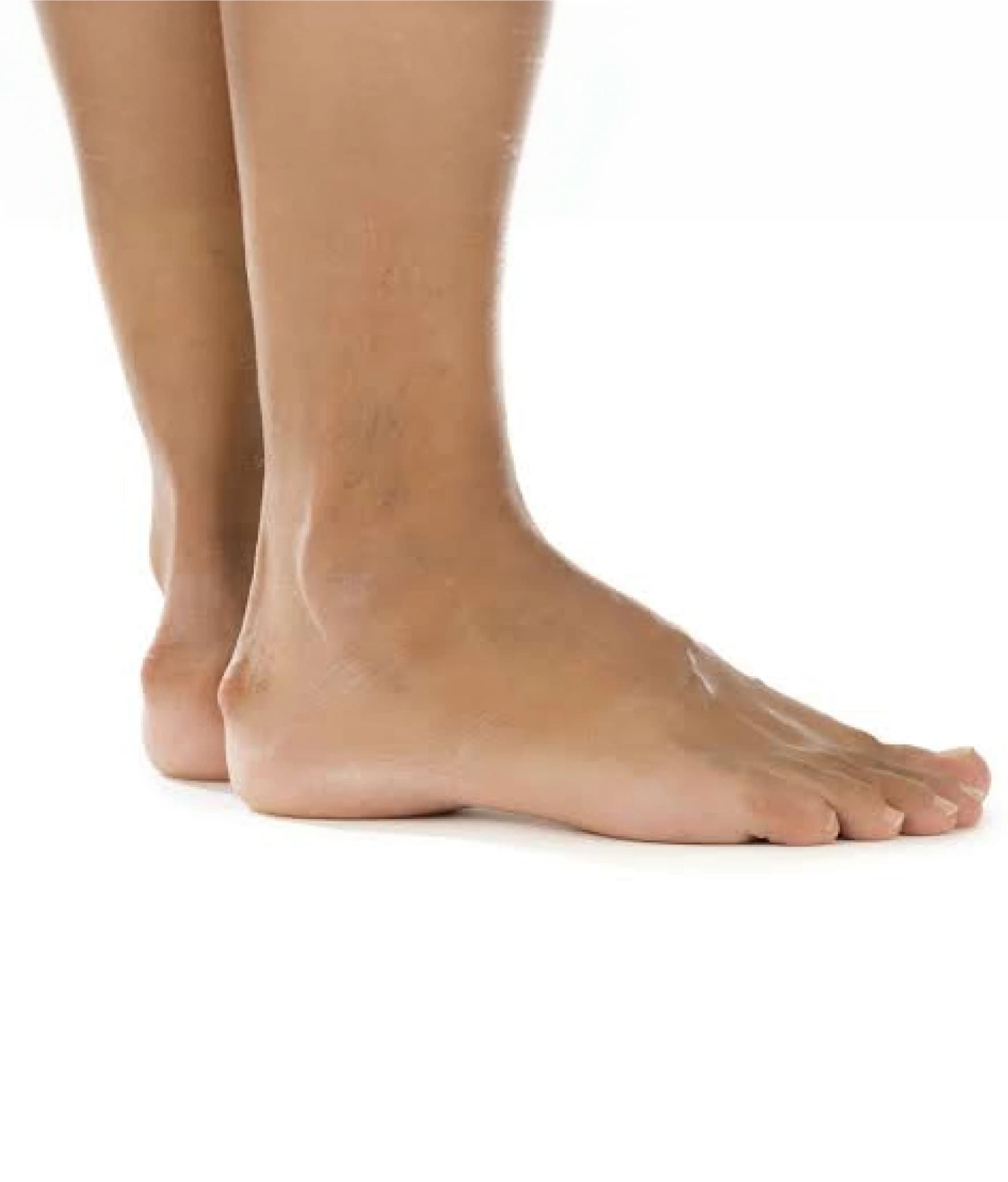 The back of the heel highlighted, where a Haglund's bump causes irritation