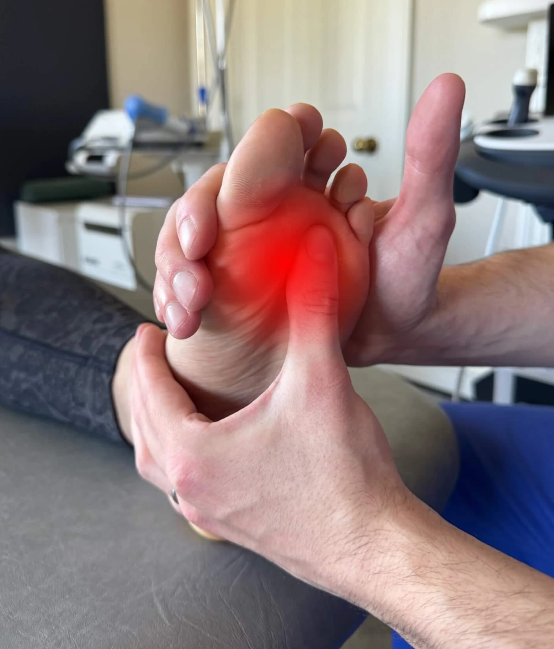 The ball of the foot highlighted, where a Morton's neuroma causes nerve pain